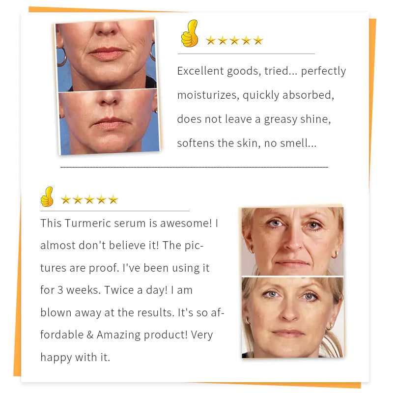 SAUVASINE 30ml Turmeric Serum for Face Care