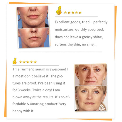 SAUVASINE 30ml Turmeric Serum for Face Care