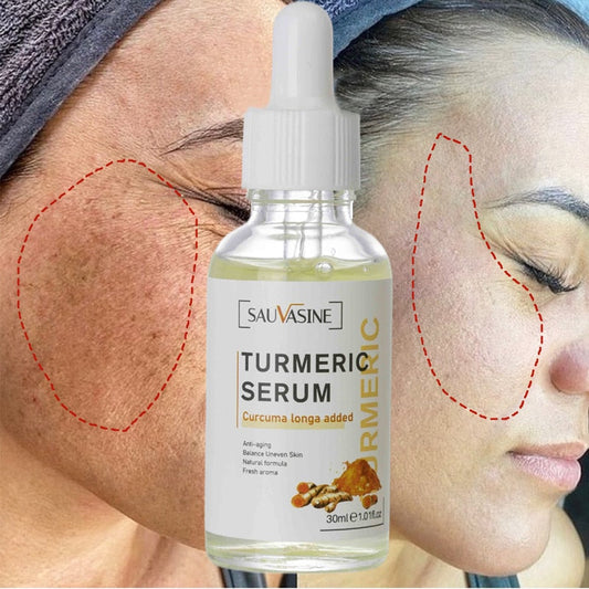 Turmeric Face Whitening Serum - Brighten Dark Spots | GLAMBEAUTY