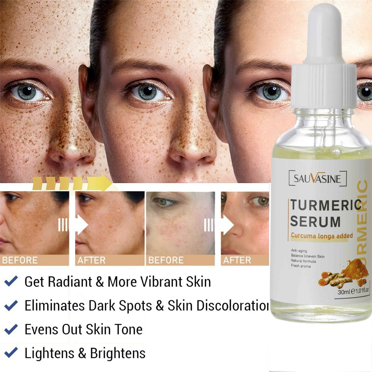 Turmeric Face Whitening Serum - Brighten Dark Spots | GLAMBEAUTY