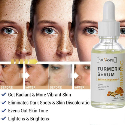 Turmeric Face Whitening Serum - Brighten Dark Spots | GLAMBEAUTY